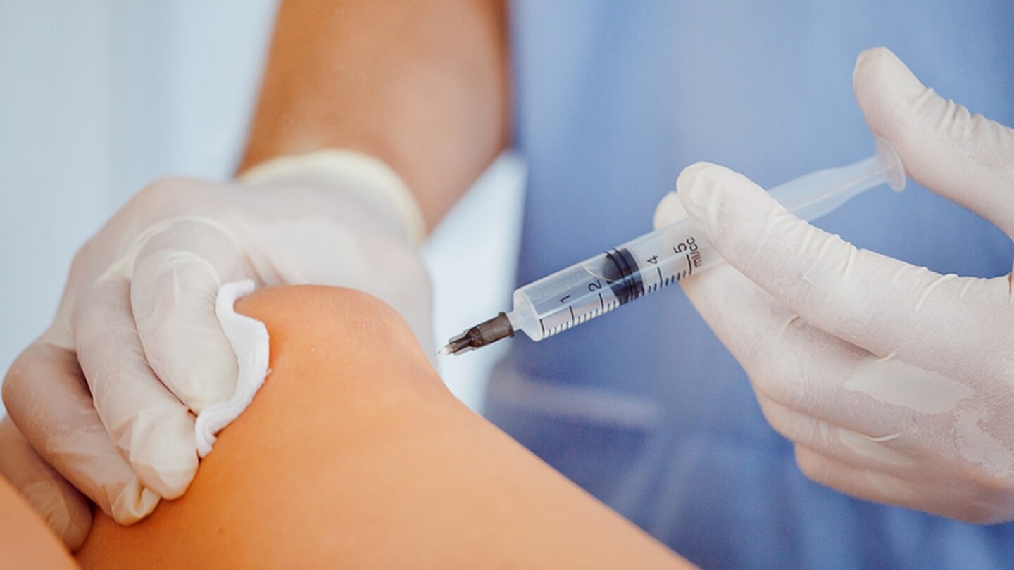 Aplicación local de ozonoterapia